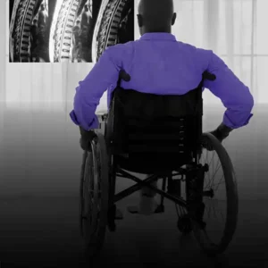 Man in wheelchair looking at spinal xrays