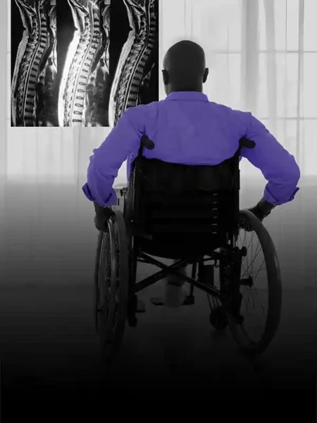 Man in wheelchair looking at spinal xrays